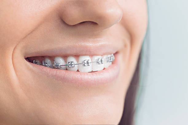 Best Veneers and Lumineers  in Bayshe, OR